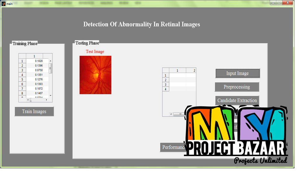 Matlab Project - Biomedical, Final year projects.