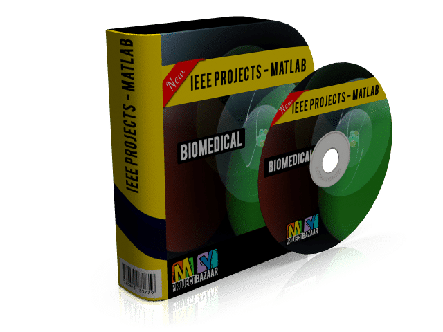 Recognizing Common CT Imaging Signs of Lung Diseases Through a New Feature Selection Method Based on Fisher Criterion and Genetic Optimization