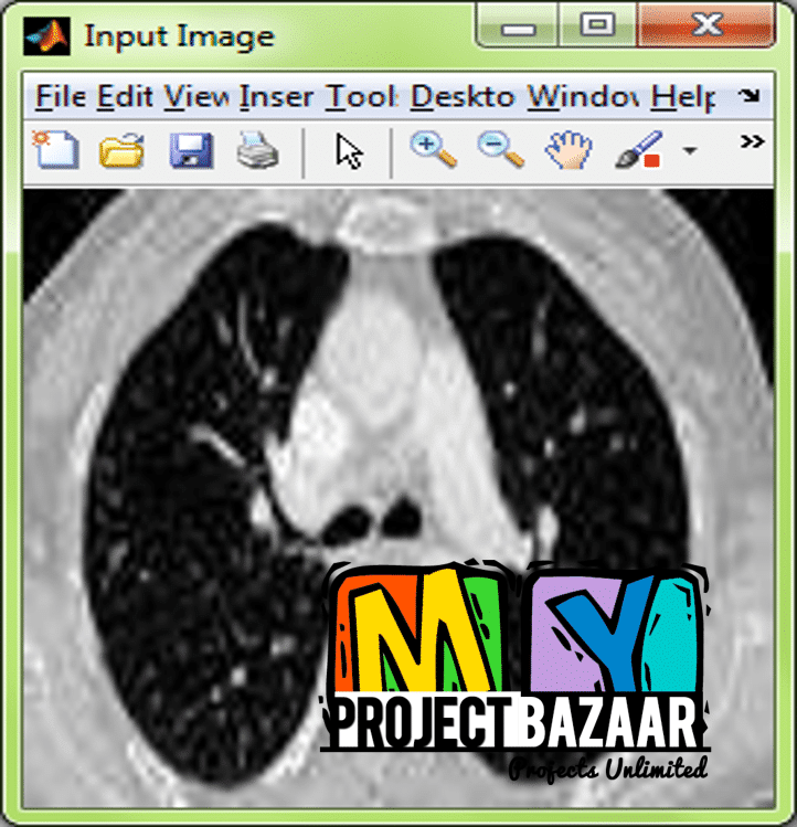 Recognizing Common CT Imaging Signs of Lung Diseases Through a New Feature Selection Method Based on Fisher Criterion and Genetic Optimization - Image 2