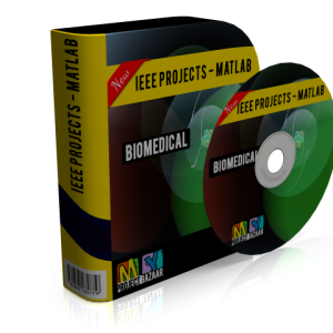 Automatic localization and segmentation of optic disc in fundus image using morphology and level set