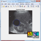 Diagnostic Classifier System for Kidney Lesions